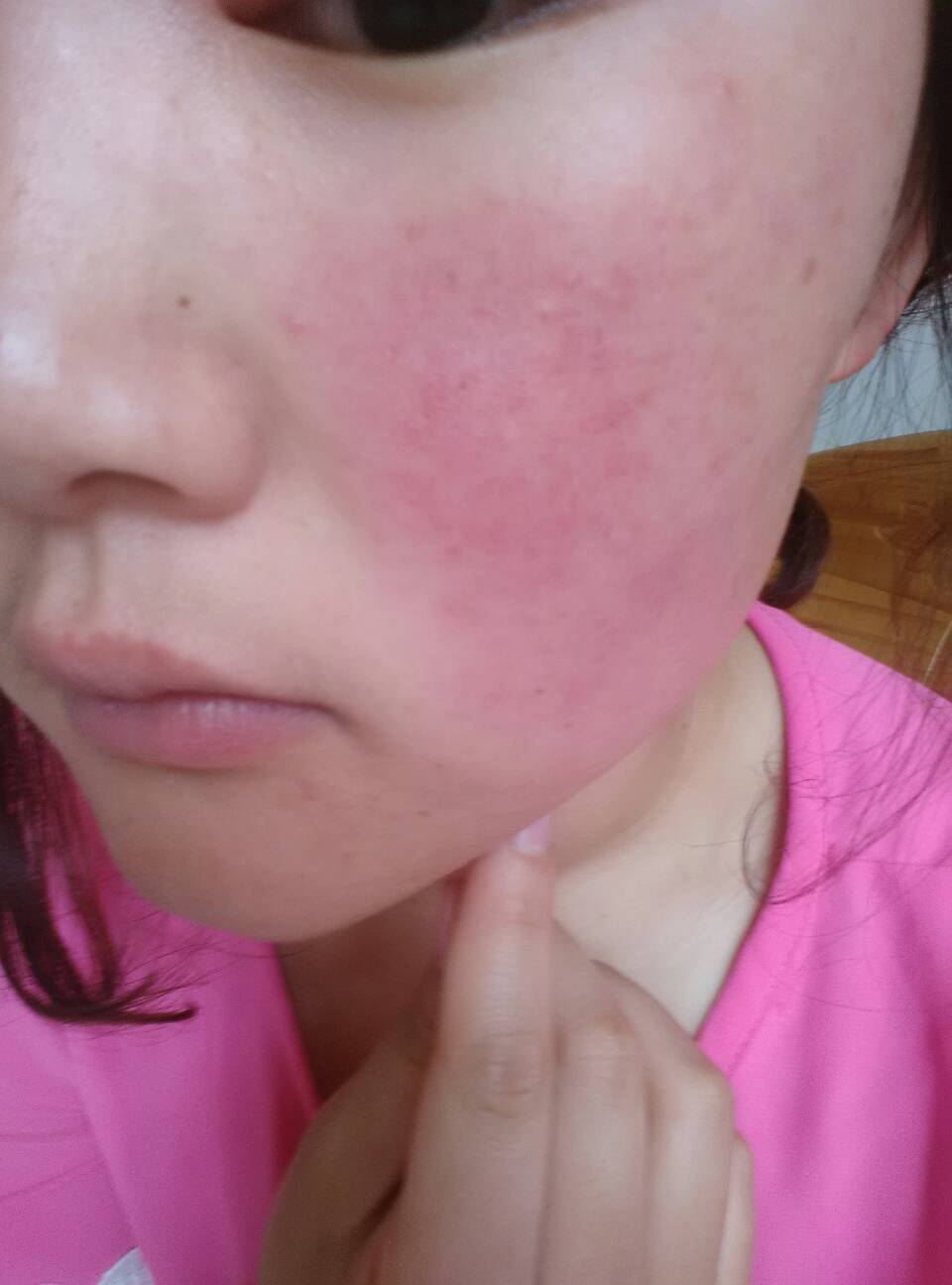 Bioderma_Matricium_Bioderma再生水_ 醫學實證_激生膠原_去紋_補水_提升免疫力_敏感_泛紅_降紅_抗敏_敏感肌_敏感肌產品推薦_修復肌膚